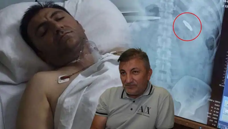 15 Temmuz’un Unutulmaz Yarası: 9 Yıldır Kurşunla Yaşamak
